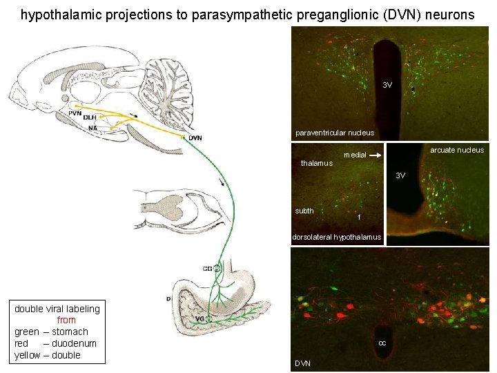 hypothalamic projections to parasympathetic preganglionic (DVN) neurons 3 V paraventricular nucleus arcuate nucleus medial hypothalamic projections to parasympathetic preganglionic (DVN) neurons 3 V paraventricular nucleus arcuate nucleus medial
