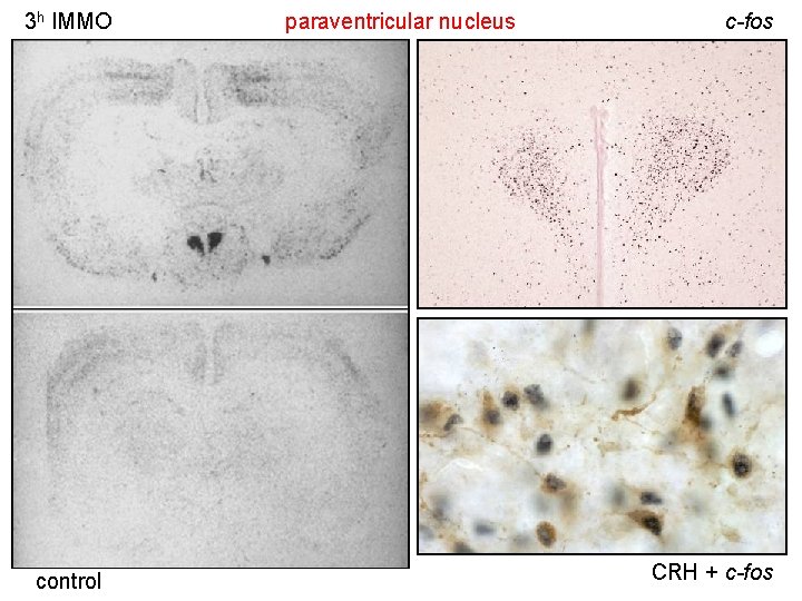 3 h IMMO control paraventricular nucleus c-fos CRH + c-fos 