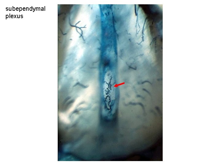 subependymal plexus 