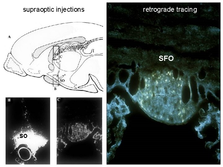 supraoptic injections retrograde tracing SFO SO 