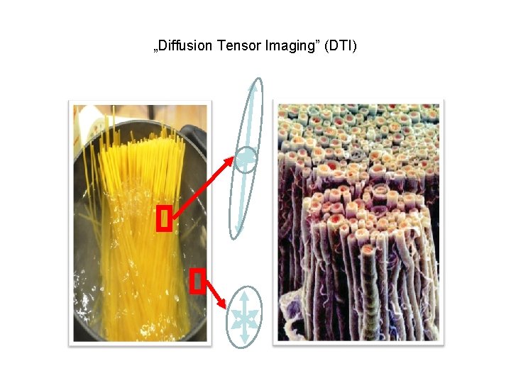 „Diffusion Tensor Imaging” (DTI) 