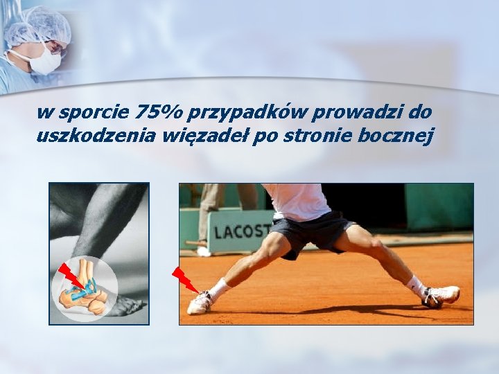 w sporcie 75% przypadków prowadzi do uszkodzenia więzadeł po stronie bocznej 