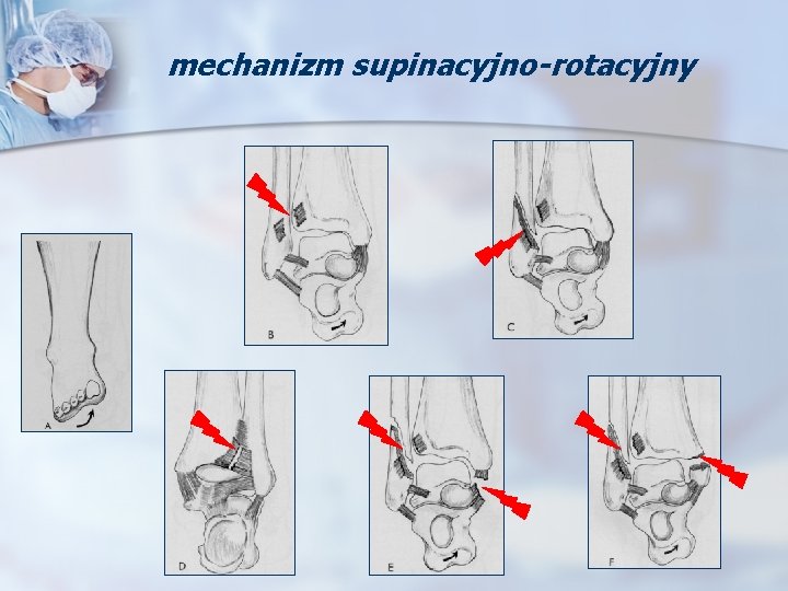 mechanizm supinacyjno-rotacyjny 