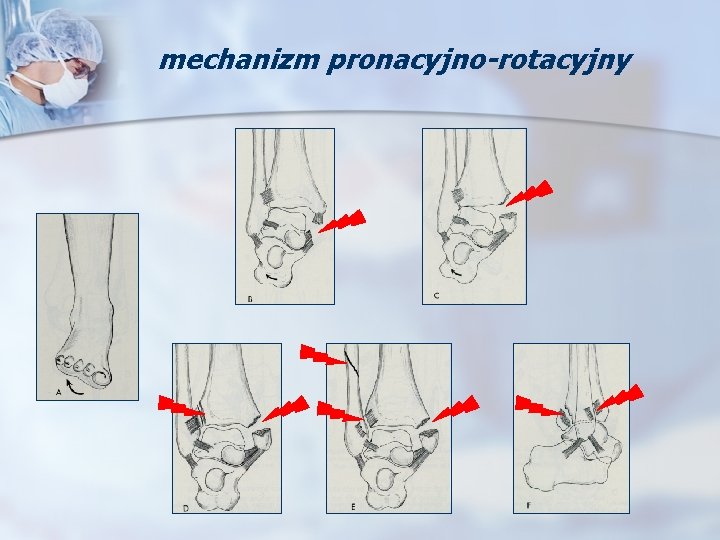 mechanizm pronacyjno-rotacyjny 