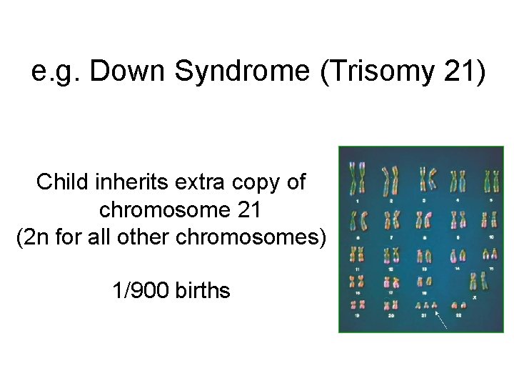 e. g. Down Syndrome (Trisomy 21) Child inherits extra copy of chromosome 21 (2