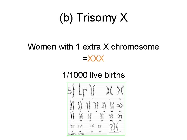 (b) Trisomy X Women with 1 extra X chromosome =XXX 1/1000 live births 