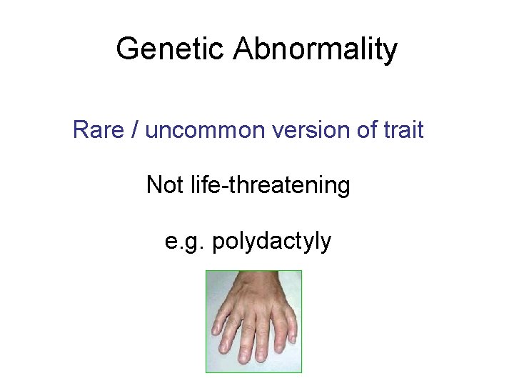 Genetic Abnormality Rare / uncommon version of trait Not life-threatening e. g. polydactyly 