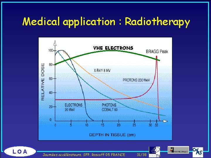 Medical application : Radiotherapy VHE ELECTRONS LOA Journées accélérateurs, SFP, Roscoff 05 FRANCE 31/38