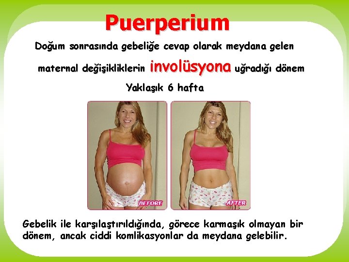 Puerperium Doğum sonrasında gebeliğe cevap olarak meydana gelen maternal değişikliklerin involüsyona uğradığı dönem Yaklaşık