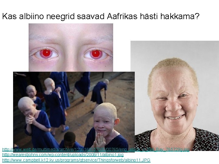 Kas albiino neegrid saavad Aafrikas hästi hakkama? http: //www. welt. de/multimedia/archive/1236168157000/00765/eng_albino_1_BM_Bay_765729 g. jpg http: