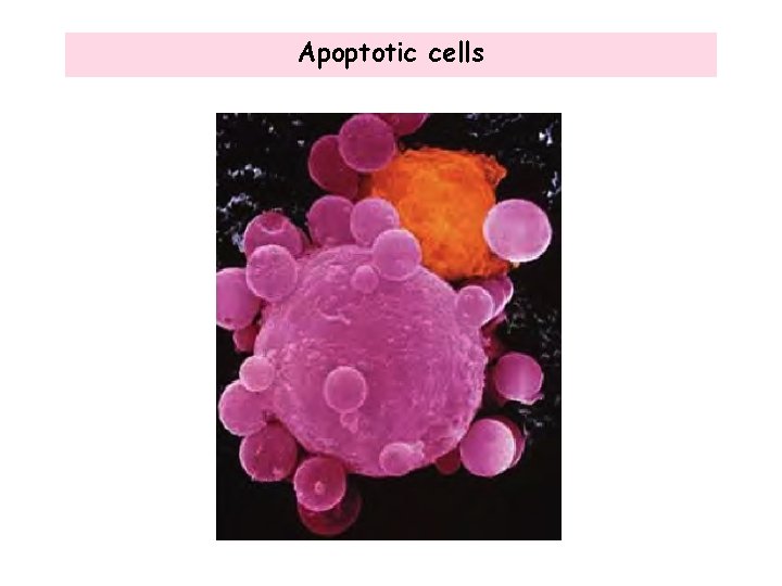 Apoptotic cells 