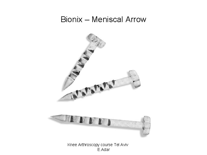 Bionix – Meniscal Arrow Knee Arthroscopy course Tel Aviv E. Adar 