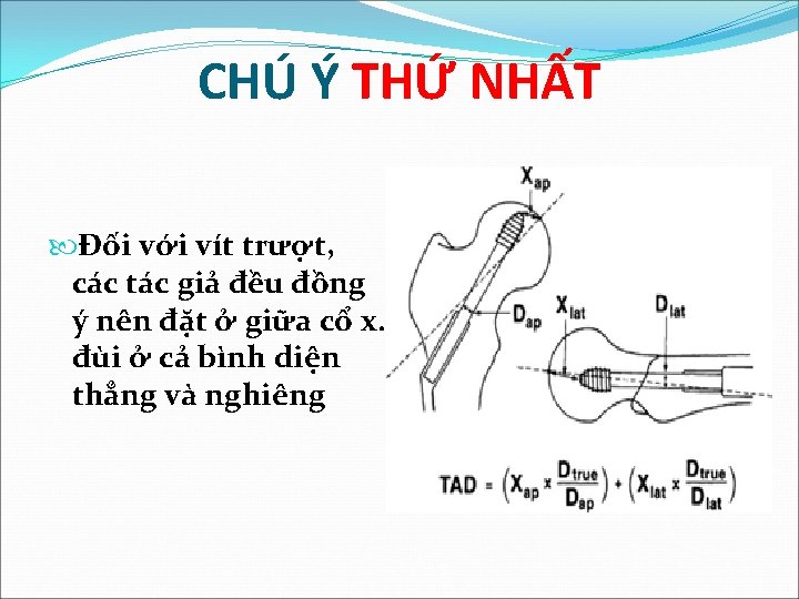 CHÚ Ý THỨ NHẤT Đối với vít trượt, các tác giả đều đồng ý