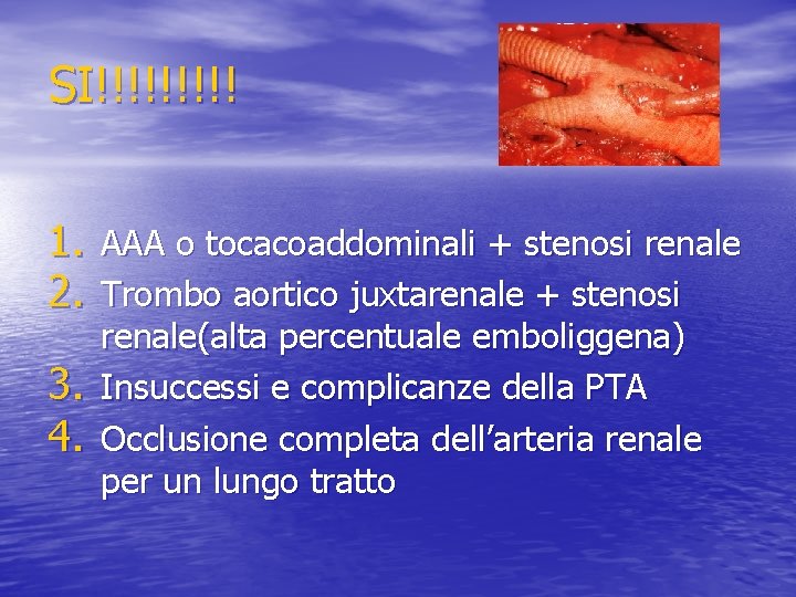 SI!!!!! 1. AAA o tocacoaddominali + stenosi renale 2. Trombo aortico juxtarenale + stenosi