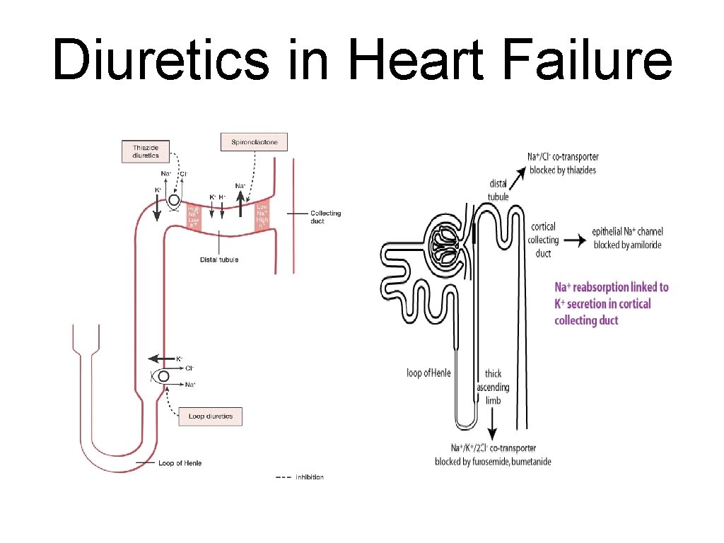 Diuretics in Heart Failure 