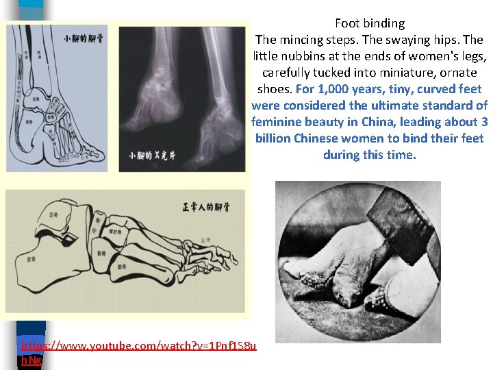 Foot binding The mincing steps. The swaying hips. The little nubbins at the ends