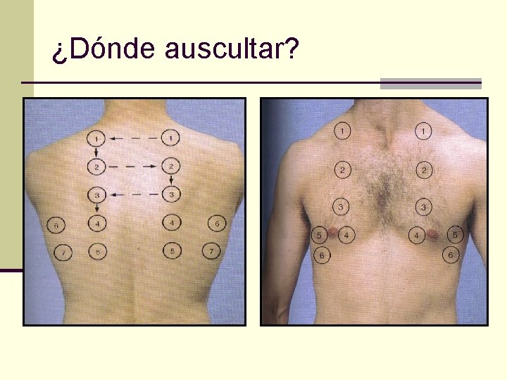 ¿Dónde auscultar? 