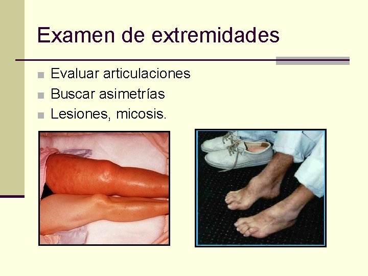 Examen de extremidades ■ Evaluar articulaciones ■ Buscar asimetrías ■ Lesiones, micosis. 