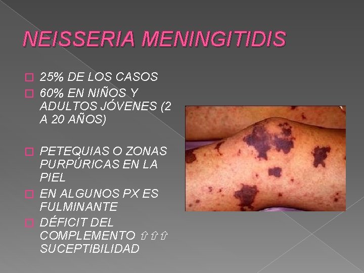 NEISSERIA MENINGITIDIS 25% DE LOS CASOS � 60% EN NIÑOS Y ADULTOS JÓVENES (2