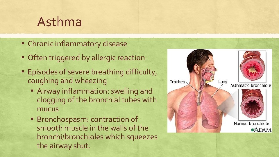 Asthma ▪ Chronic inflammatory disease ▪ Often triggered by allergic reaction ▪ Episodes of