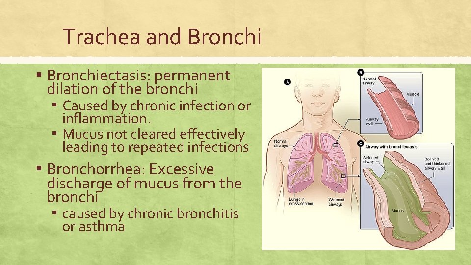 Trachea and Bronchi ▪ Bronchiectasis: permanent dilation of the bronchi ▪ Caused by chronic