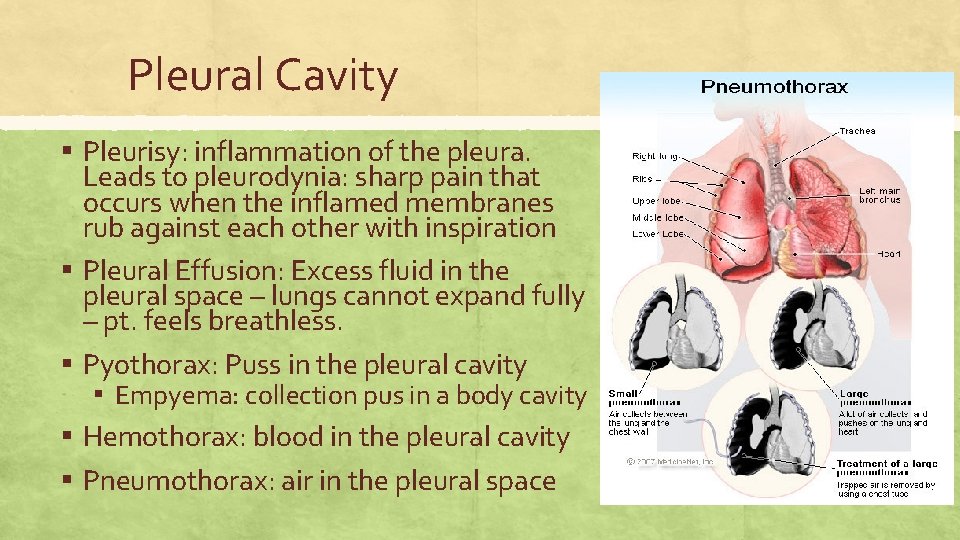 Pleural Cavity ▪ Pleurisy: inflammation of the pleura. ▪ ▪ Leads to pleurodynia: sharp