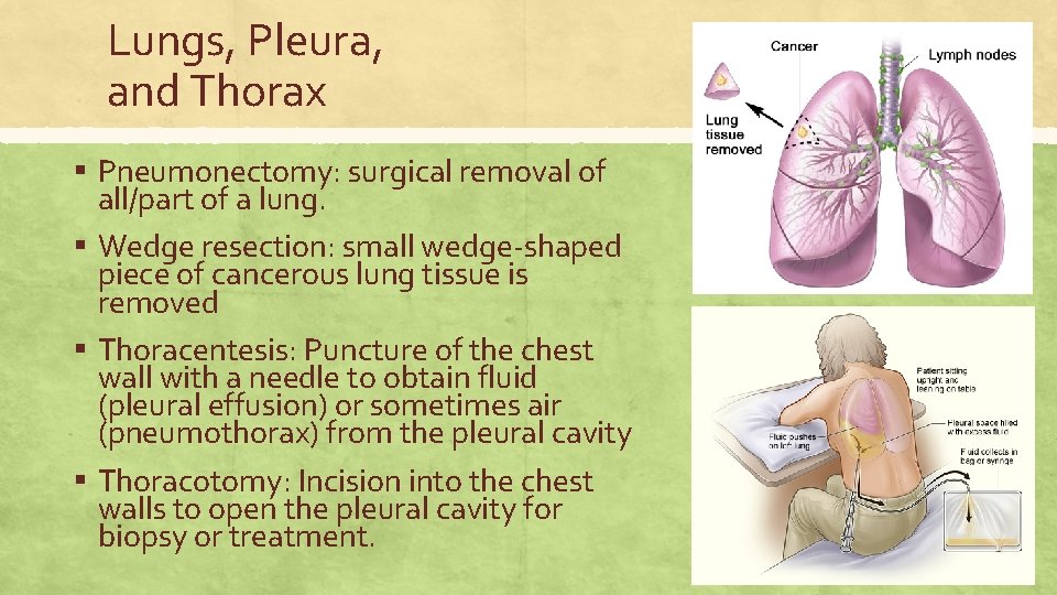 Lungs, Pleura, and Thorax ▪ Pneumonectomy: surgical removal of all/part of a lung. ▪