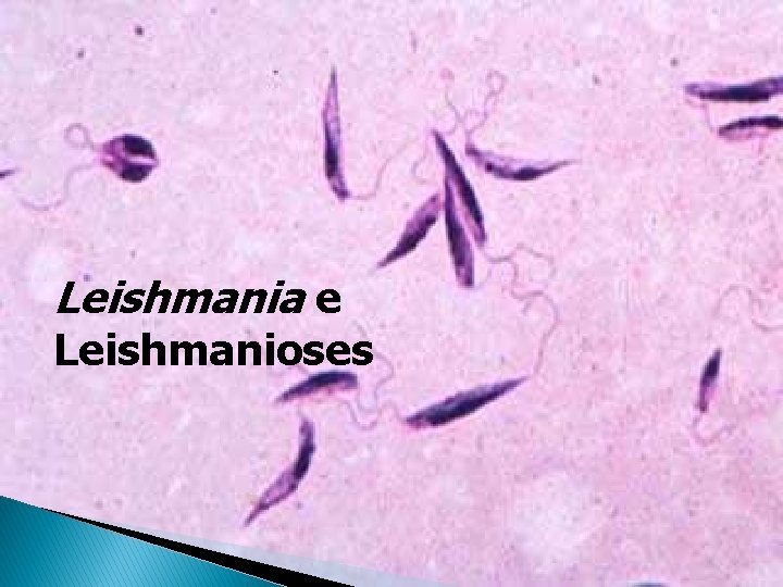 Leishmania e Leishmanioses Leishmania e Leishmanioses