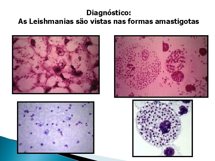 Diagnóstico: As Leishmanias são vistas nas formas amastigotas Diagnóstico: As Leishmanias são vistas nas formas amastigotas