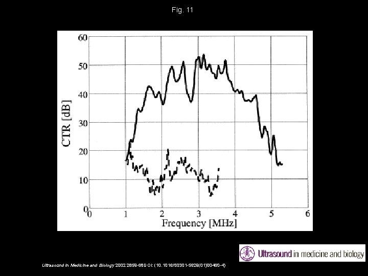 Fig. 11 Ultrasound in Medicine and Biology 2002 2859 -68 DOI: (10. 1016/S 0301