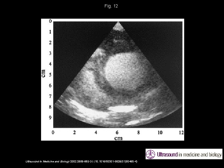 Fig. 12 Ultrasound in Medicine and Biology 2002 2859 -68 DOI: (10. 1016/S 0301