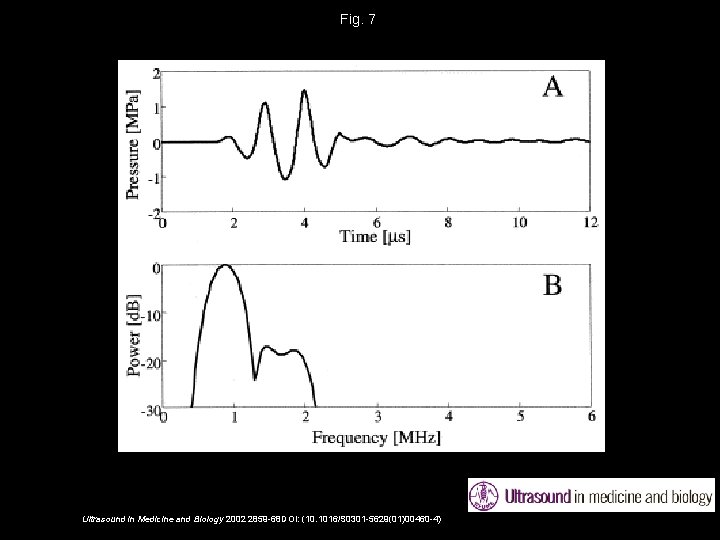 Fig. 7 Ultrasound in Medicine and Biology 2002 2859 -68 DOI: (10. 1016/S 0301