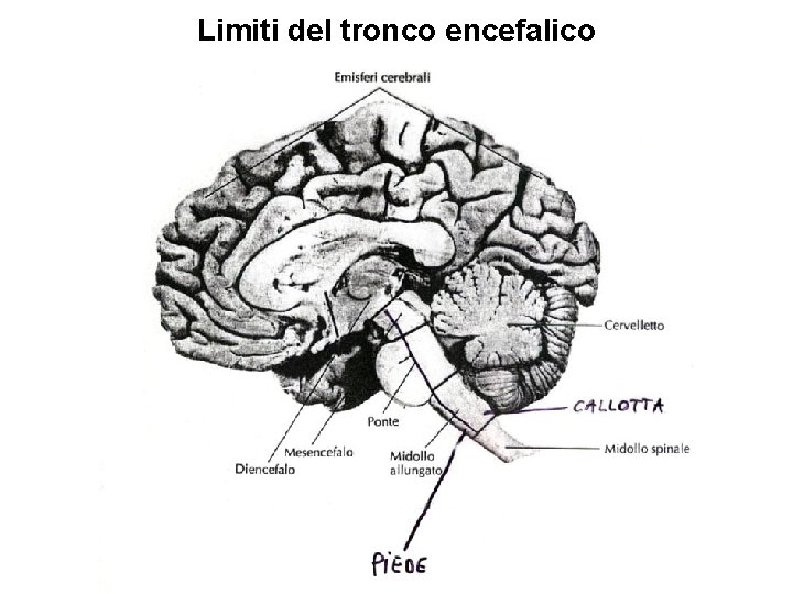 Limiti del tronco encefalico 