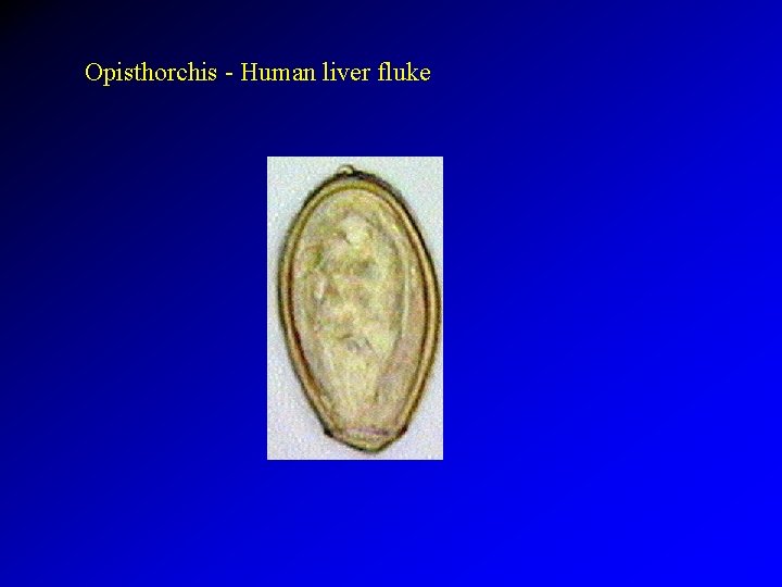 Opisthorchis - Human liver fluke 