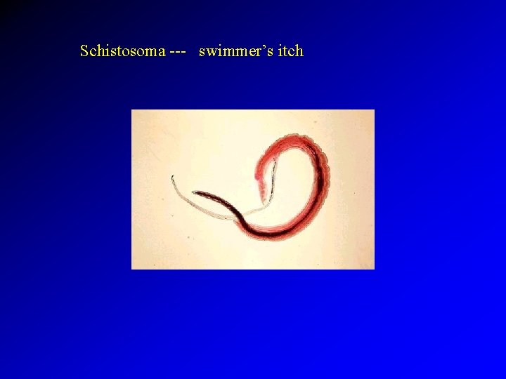 Schistosoma --- swimmer’s itch 