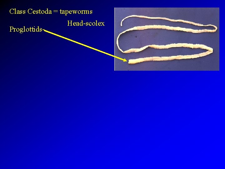 Class Cestoda = tapeworms Proglottids- Head-scolex 
