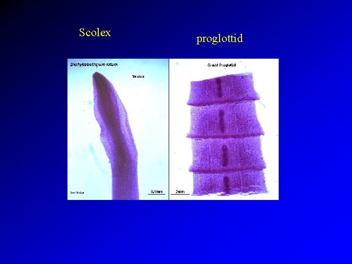 Scolex proglottid 