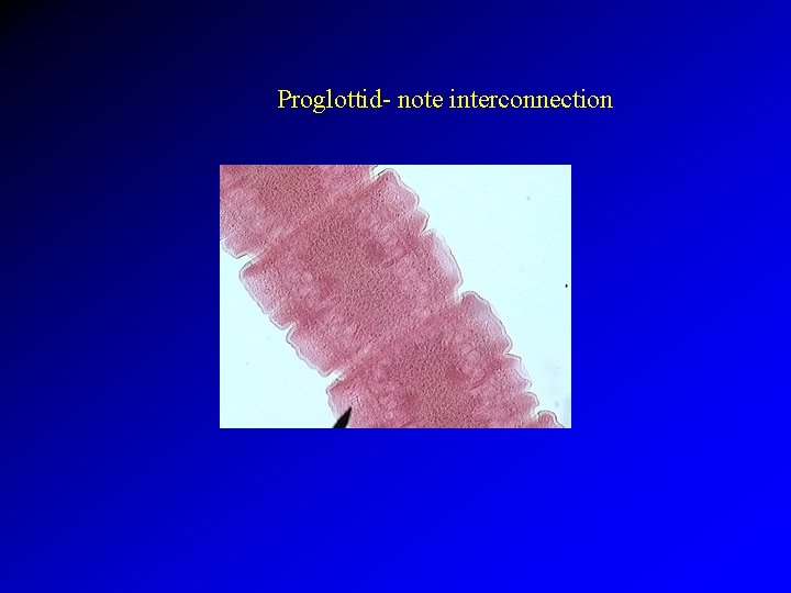 Proglottid- note interconnection 