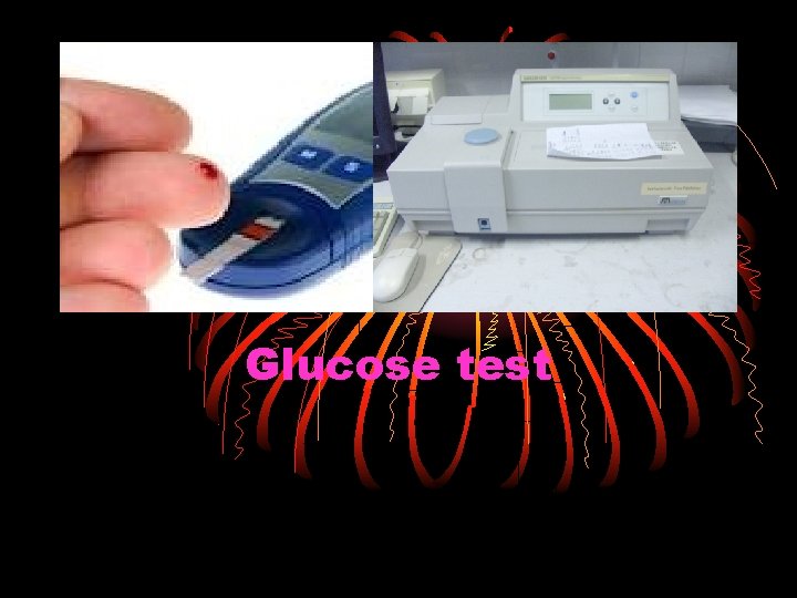 Glucose test 