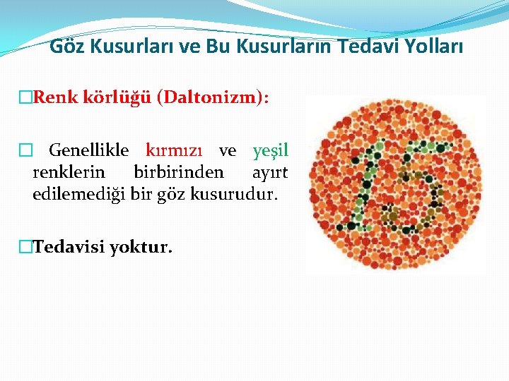 Göz Kusurları ve Bu Kusurların Tedavi Yolları �Renk körlüğü (Daltonizm): � Genellikle kırmızı ve