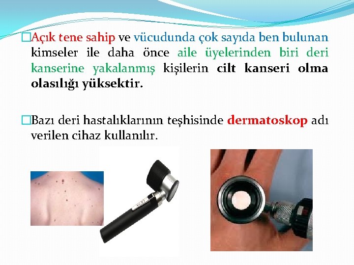 �Açık tene sahip ve vücudunda çok sayıda ben bulunan kimseler ile daha önce aile