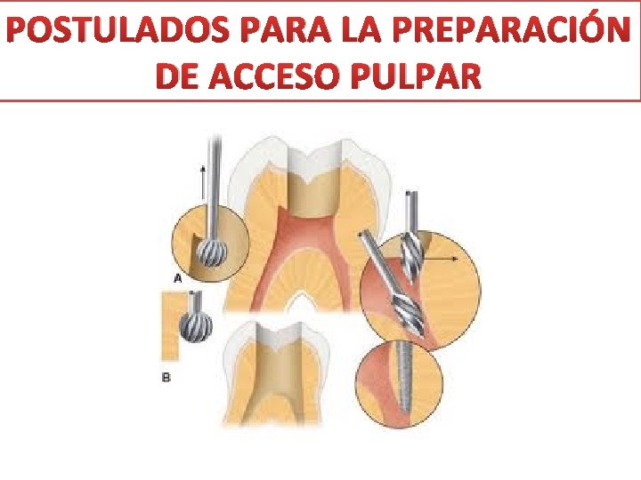 POSTULADOS PARA LA PREPARACIÓN DE ACCESO PULPAR 
