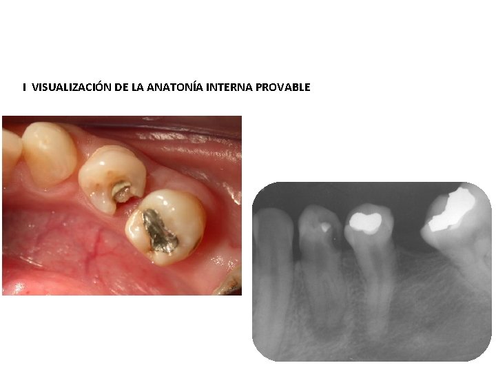 I VISUALIZACIÓN DE LA ANATONÍA INTERNA PROVABLE 