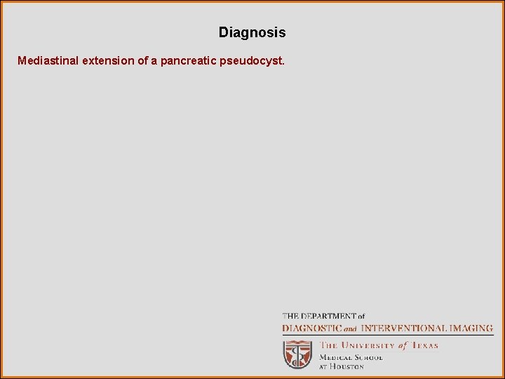 Diagnosis Mediastinal extension of a pancreatic pseudocyst. 