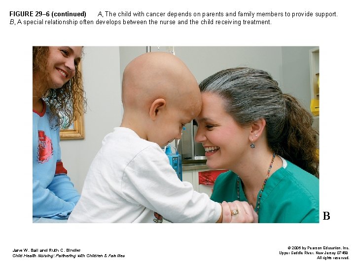 FIGURE 29– 6 (continued) A, The child with cancer depends on parents and family FIGURE 29– 6 (continued) A, The child with cancer depends on parents and family