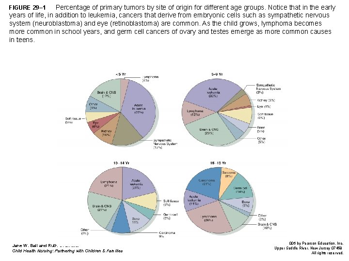 Percentage of primary tumors by site of origin for different age groups. Notice that Percentage of primary tumors by site of origin for different age groups. Notice that