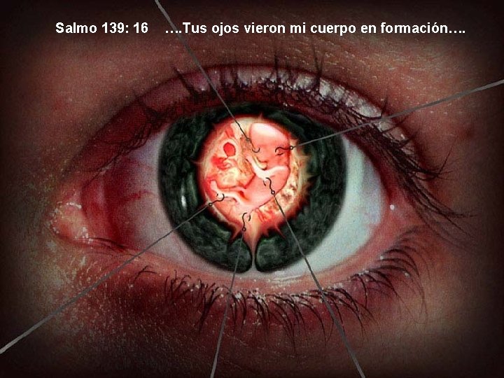 Salmo 139: 16 …. Tus ojos vieron mi cuerpo en formación…. 