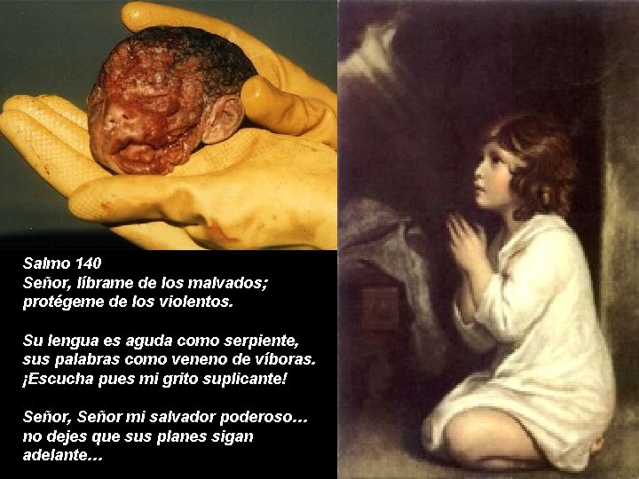 Salmo 140 Señor, líbrame de los malvados; protégeme de los violentos. Su lengua es
