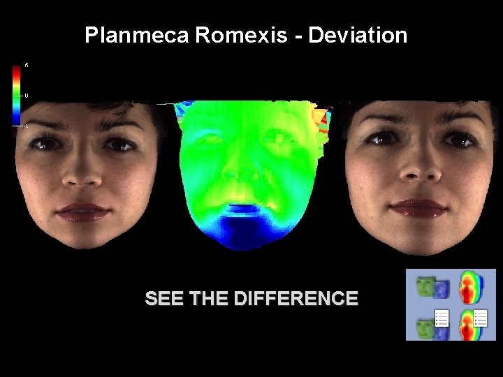 Planmeca Romexis - Deviation SEE THE DIFFERENCE 