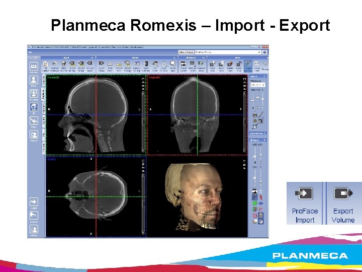 Planmeca Romexis – Import - Export 